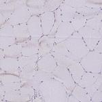 DDB2 Antibody in Immunohistochemistry (IHC)