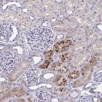 PR38A Antibody in Immunohistochemistry (Paraffin) (IHC (P))