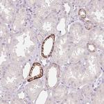 FXYD4 Polyclonal Antibody