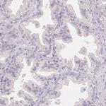 FXYD4 Antibody in Immunohistochemistry (Paraffin) (IHC (P))