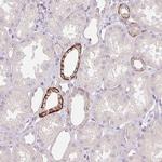 FXYD4 Antibody in Immunohistochemistry (IHC)