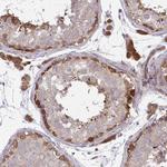 LMNTD2 Antibody in Immunohistochemistry (Paraffin) (IHC (P))
