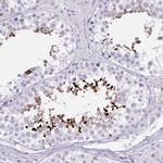 LRRC36 Polyclonal Antibody