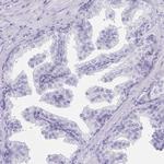 LRRC36 Antibody in Immunohistochemistry (IHC)