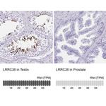 LRRC36 Antibody