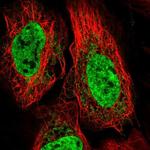 TNNC2 Polyclonal Antibody