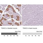 TNNC2 Antibody in Immunohistochemistry (IHC)
