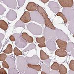 TNNC2 Antibody in Immunohistochemistry (IHC)