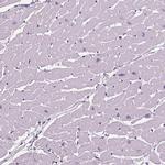 TNNC2 Antibody in Immunohistochemistry (IHC)