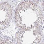 C19orf55 Antibody in Immunohistochemistry (IHC)