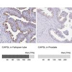 CAPSL Antibody in Immunohistochemistry (IHC)