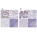 CAPSL Antibody in Immunohistochemistry (IHC)