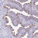 CAPSL Antibody in Immunohistochemistry (IHC)