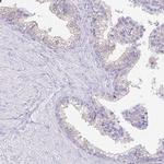 CAPSL Antibody in Immunohistochemistry (IHC)