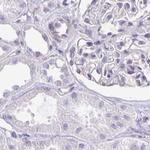 CAPSL Antibody in Immunohistochemistry (IHC)