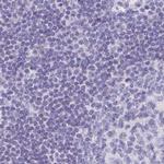 CAPSL Antibody in Immunohistochemistry (IHC)
