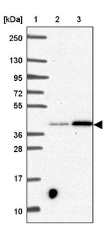 SLC39A3 Antibody in Western Blot (WB)