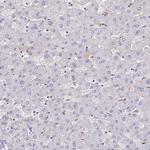 GRID2 Polyclonal Antibody