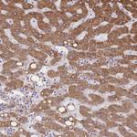 Cytochrome B5 Antibody in Immunohistochemistry (Paraffin) (IHC (P))