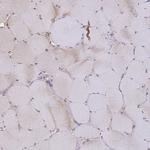 Cytochrome B5 Antibody in Immunohistochemistry (Paraffin) (IHC (P))