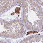 Cytochrome B5 Antibody in Immunohistochemistry (Paraffin) (IHC (P))