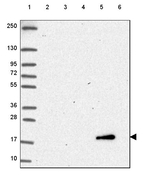 Cytochrome B5 Antibody in Western Blot (WB)