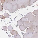 Cytochrome B5 Antibody in Immunohistochemistry (IHC)