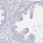 DMRTB1 Antibody in Immunohistochemistry (IHC)