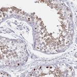DMRTB1 Antibody in Immunohistochemistry (IHC)