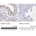 DMRTB1 Antibody