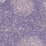 Smoothelin Antibody in Immunohistochemistry (Paraffin) (IHC (P))