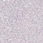 Smoothelin Polyclonal Antibody
