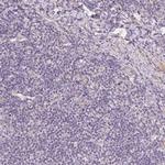 Smoothelin Antibody in Immunohistochemistry (IHC)