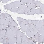 USP35 Polyclonal Antibody