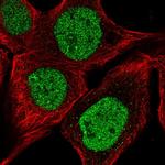 DNAJB6 Polyclonal Antibody