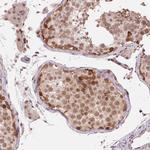 DNAJB6 Antibody in Immunohistochemistry (Paraffin) (IHC (P))