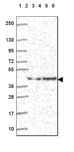DNAJB6 Antibody in Western Blot (WB)