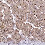 ELF4 Antibody in Immunohistochemistry (IHC)