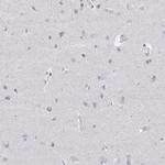 ELF4 Antibody in Immunohistochemistry (IHC)