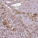 NGB Antibody in Immunohistochemistry (Paraffin) (IHC (P))