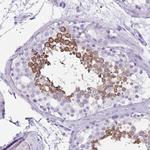 CLGN Polyclonal Antibody