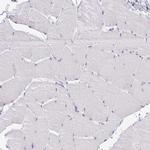 CLGN Antibody in Immunohistochemistry (IHC)