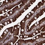 PGRMC2 Polyclonal Antibody