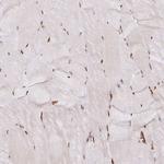 hnRNP U Antibody in Immunohistochemistry (Paraffin) (IHC (P))