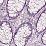 KRT82 Antibody in Immunohistochemistry (IHC)