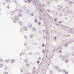 KRT82 Antibody in Immunohistochemistry (IHC)