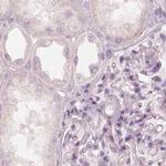 KRT82 Antibody in Immunohistochemistry (IHC)