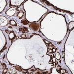 ORP5 Polyclonal Antibody