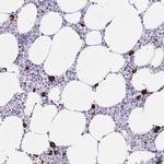 CCDC62 Polyclonal Antibody
