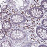 PUS7L Polyclonal Antibody